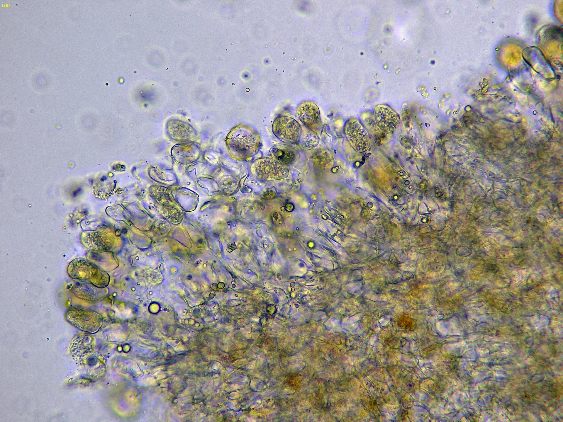 Microscopía de Puccinia smyrnii - 11 - Ecios agua x 400-001